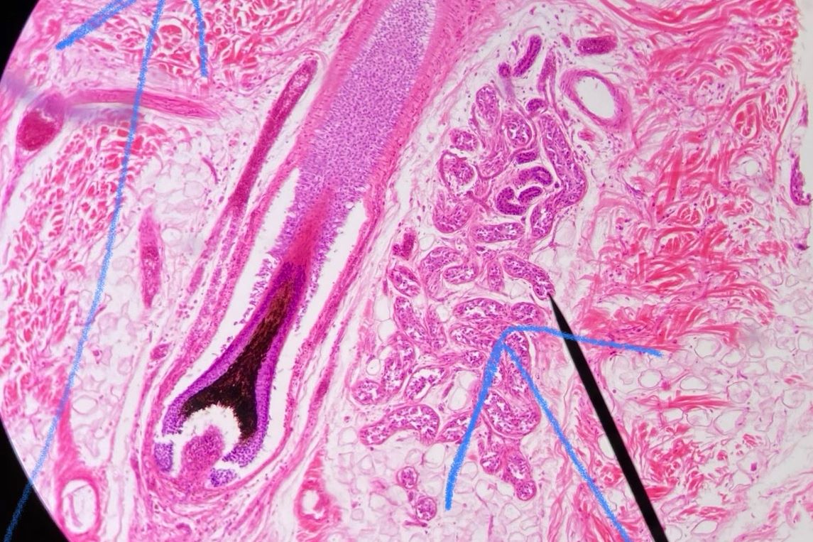 Eccrine Sweat Gland