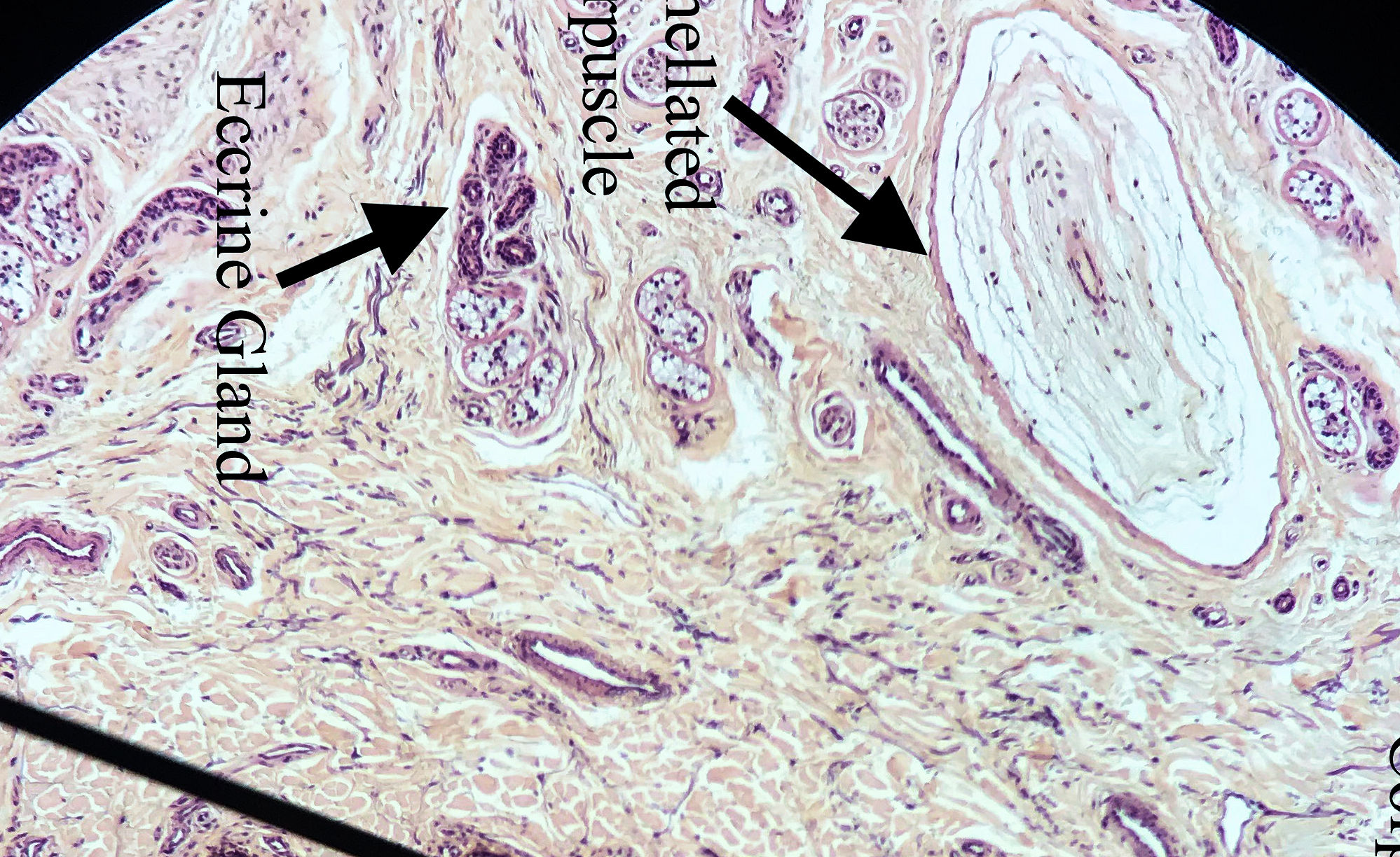 Eccrine Sweat Gland