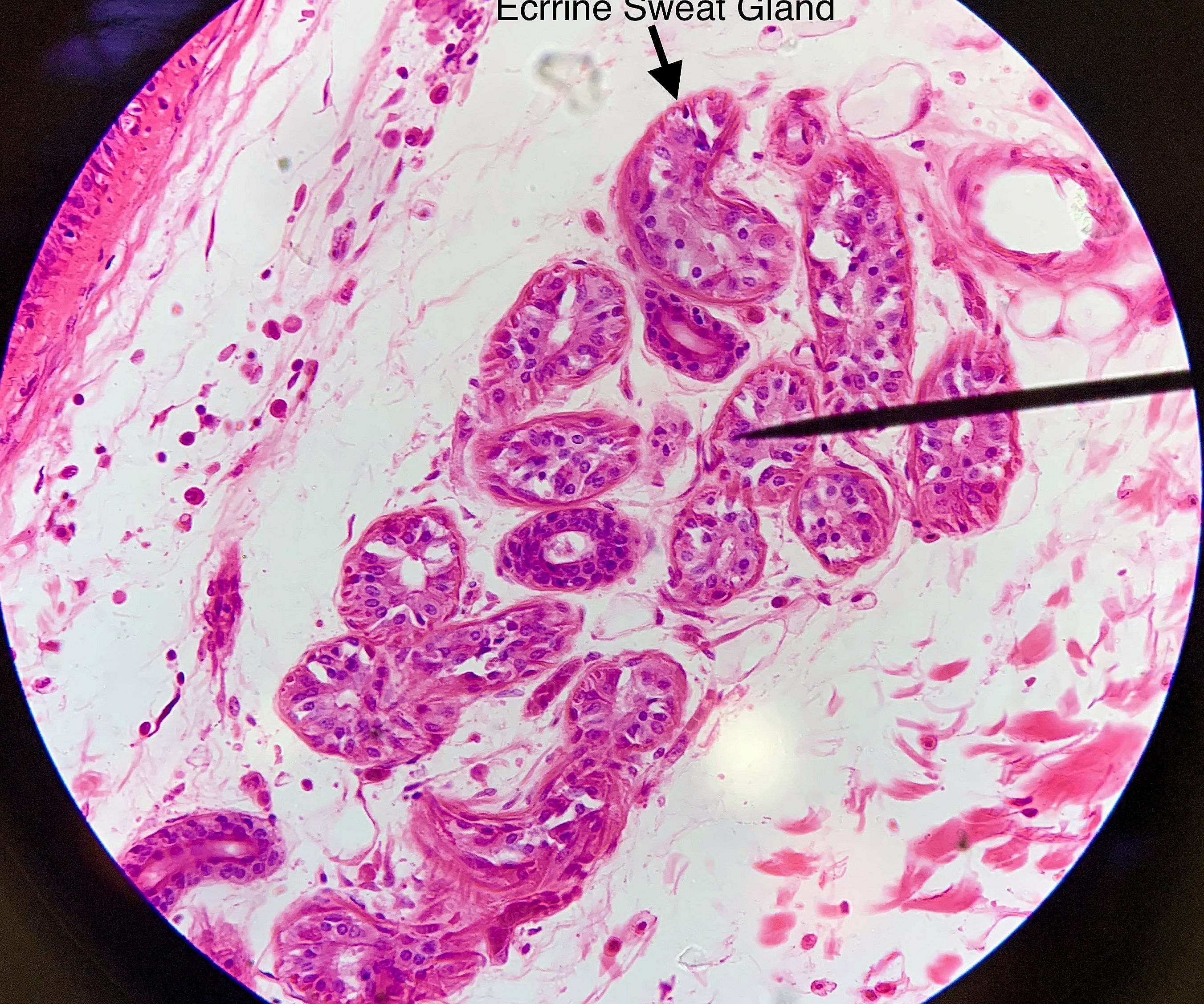 Eccrine Sweat Gland