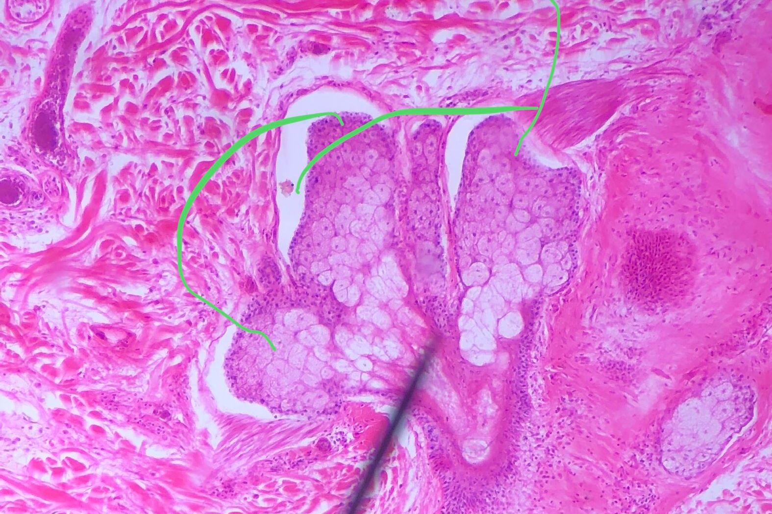 Sebaceous  gland