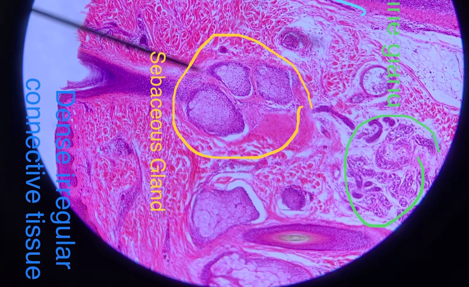 Sebaceous  Gland