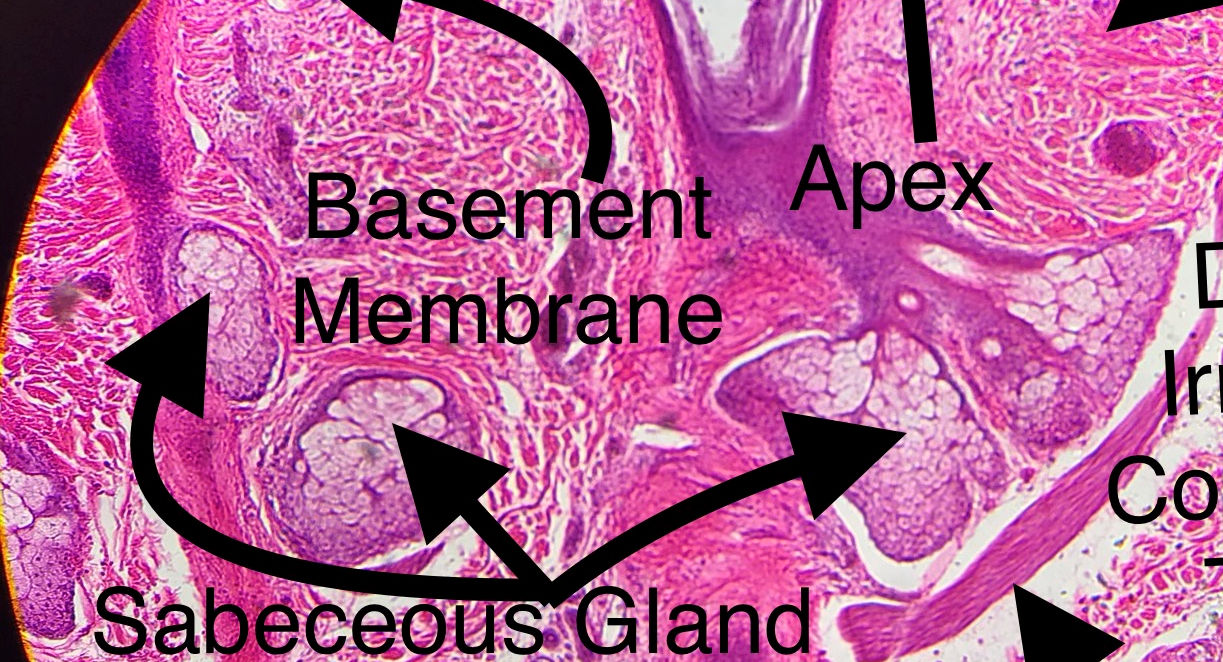 Sebaceous  Gland