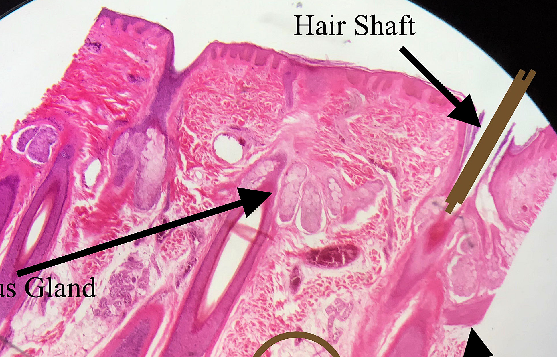 Sebaceous  Gland