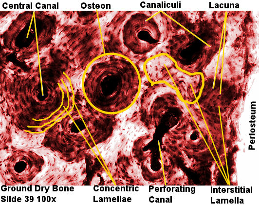 Labeled  Picture