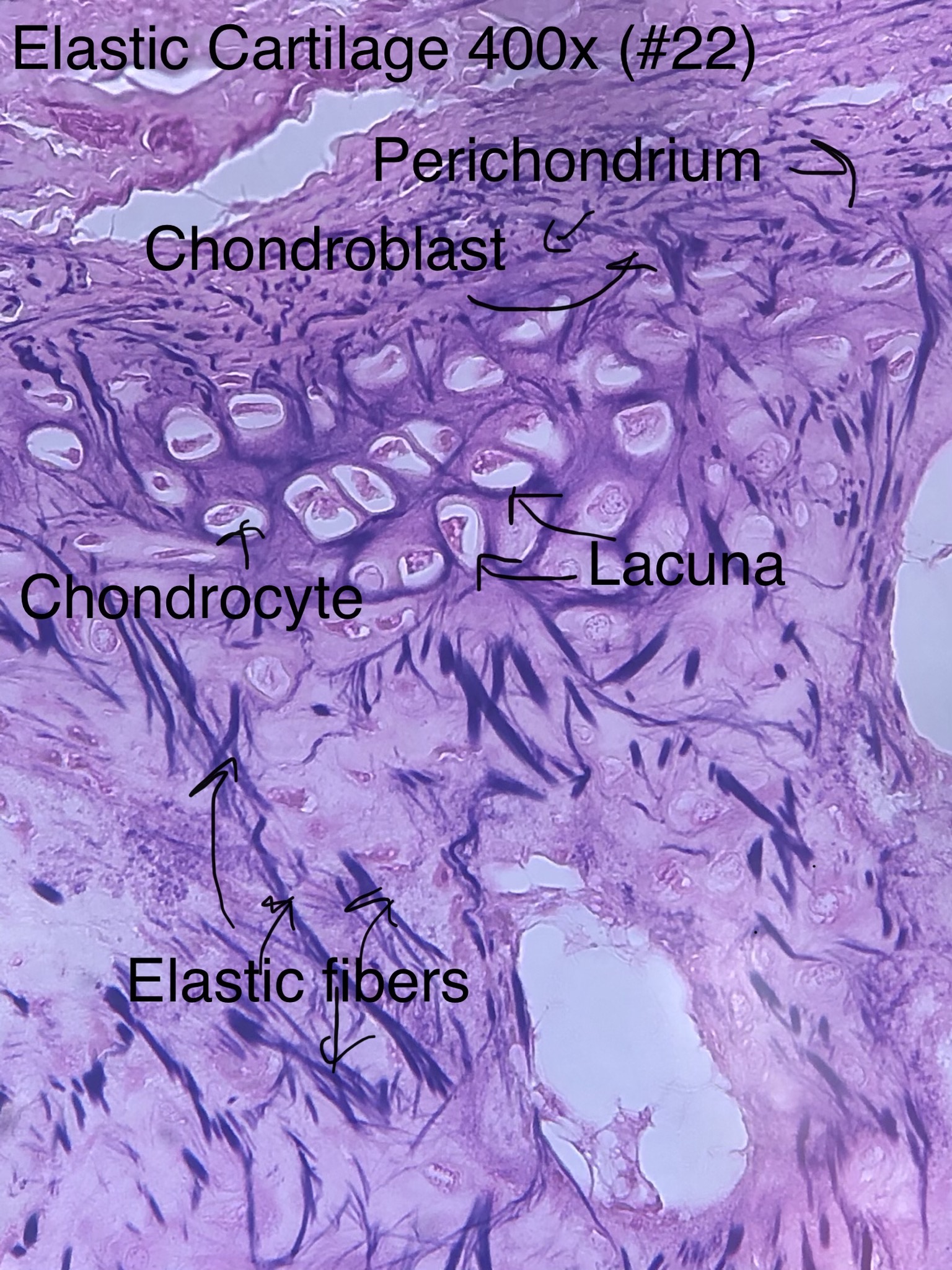 elastic cartilage