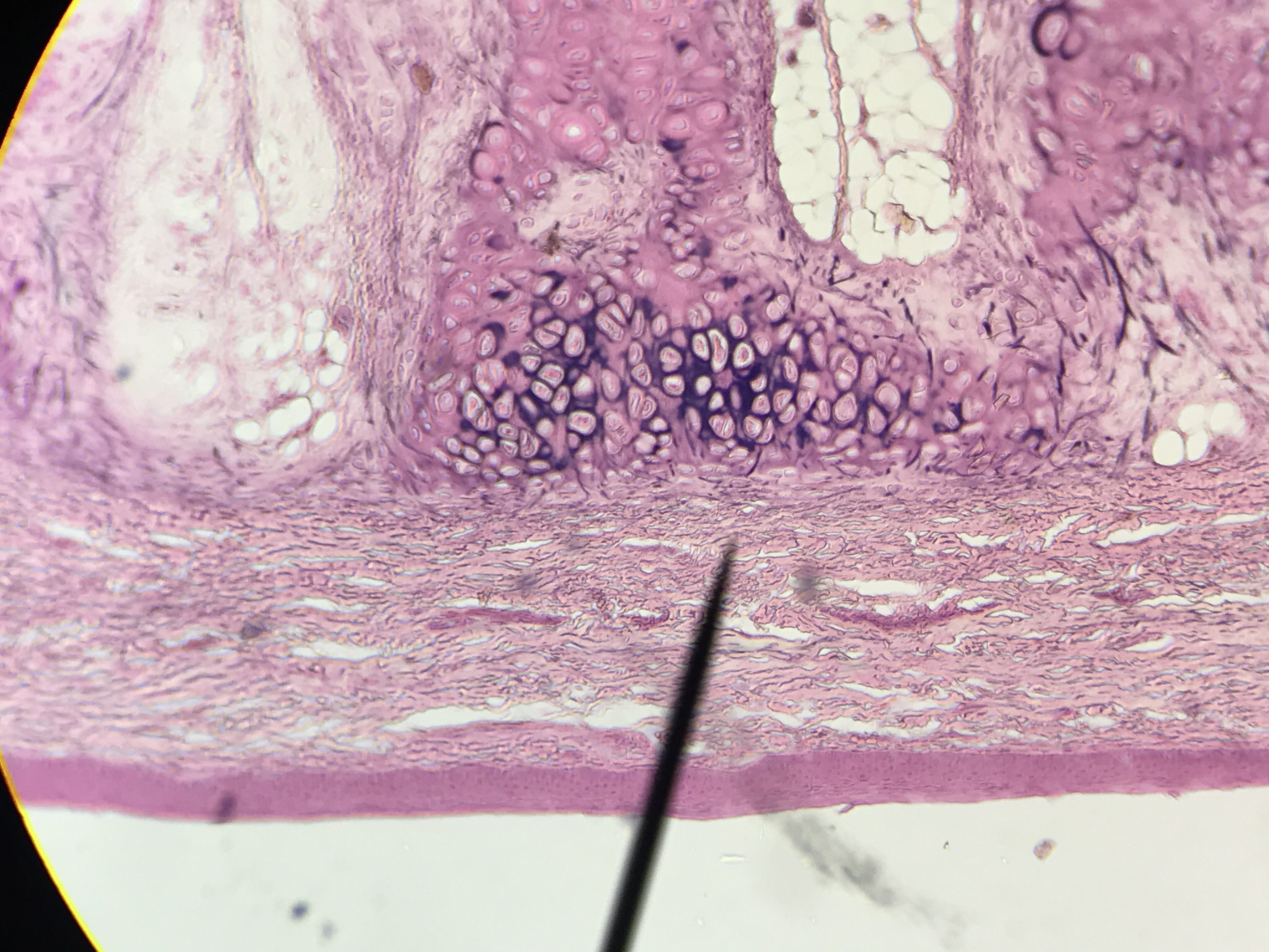 elastic cartilage