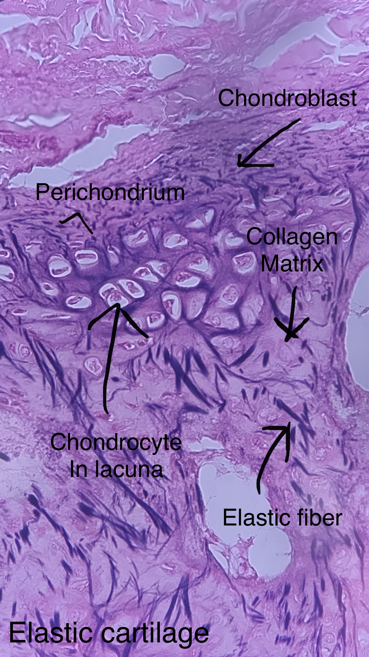 elastic cartilage