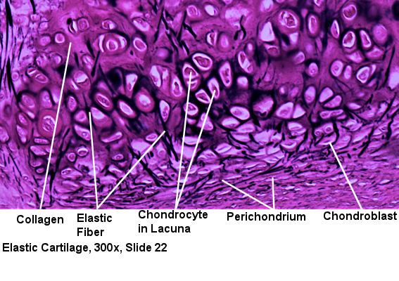 Labeled  Picture