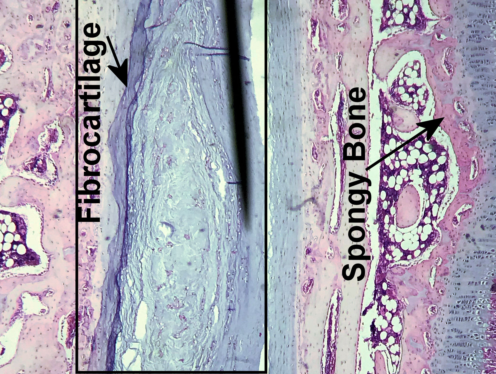 fibro cartilage