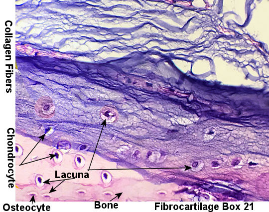 Labeled  Picture