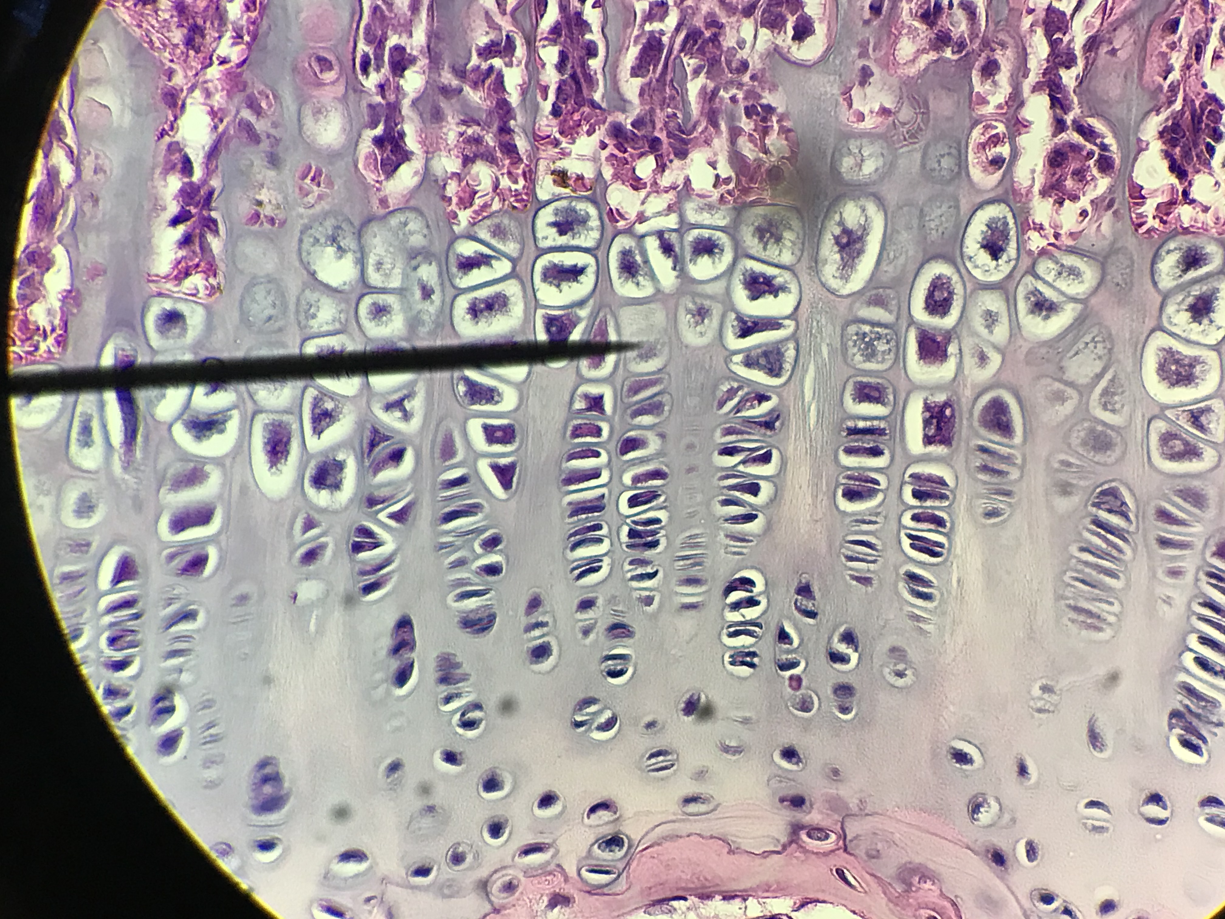 Growth Plate