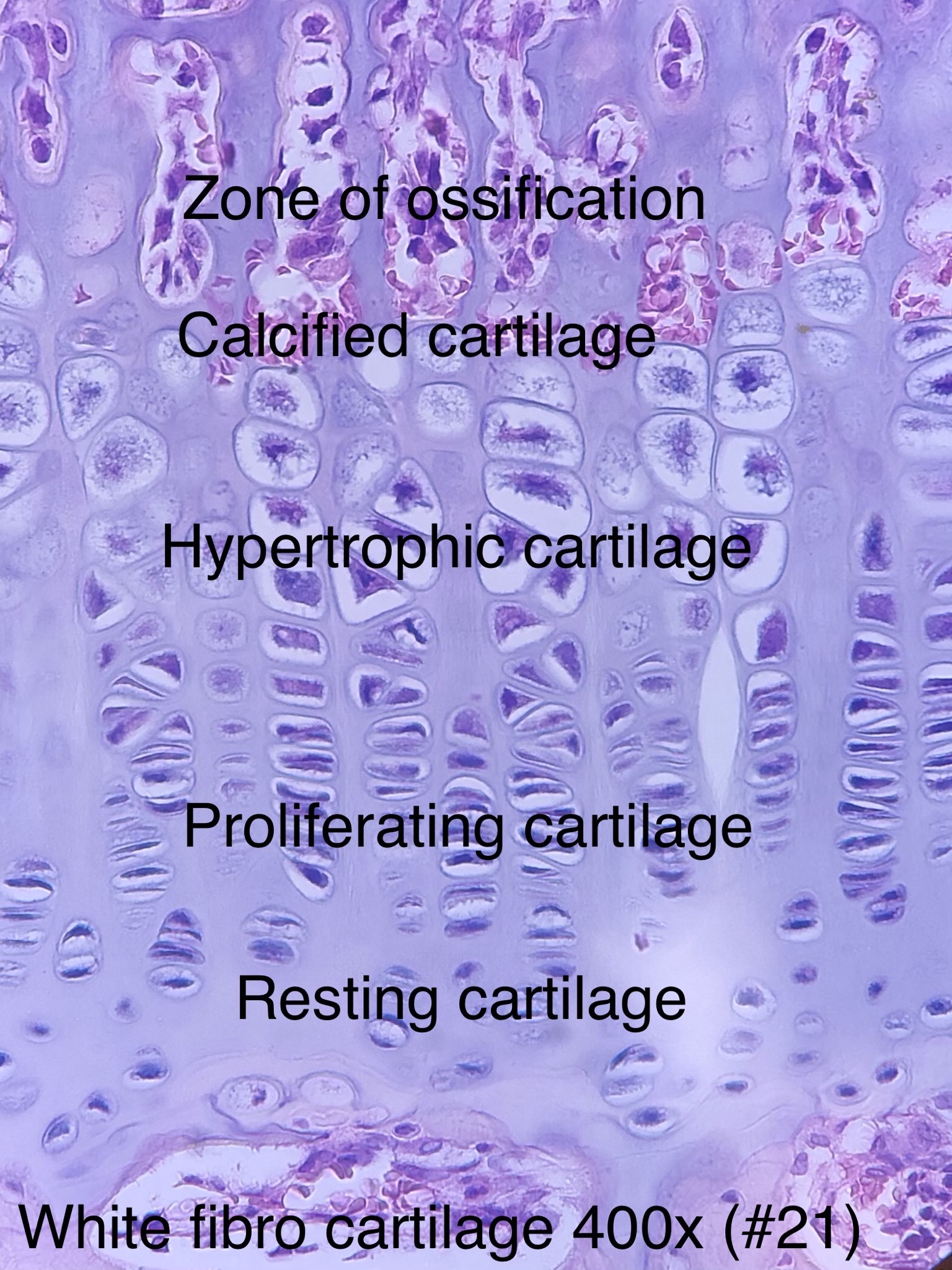 Growth Plate