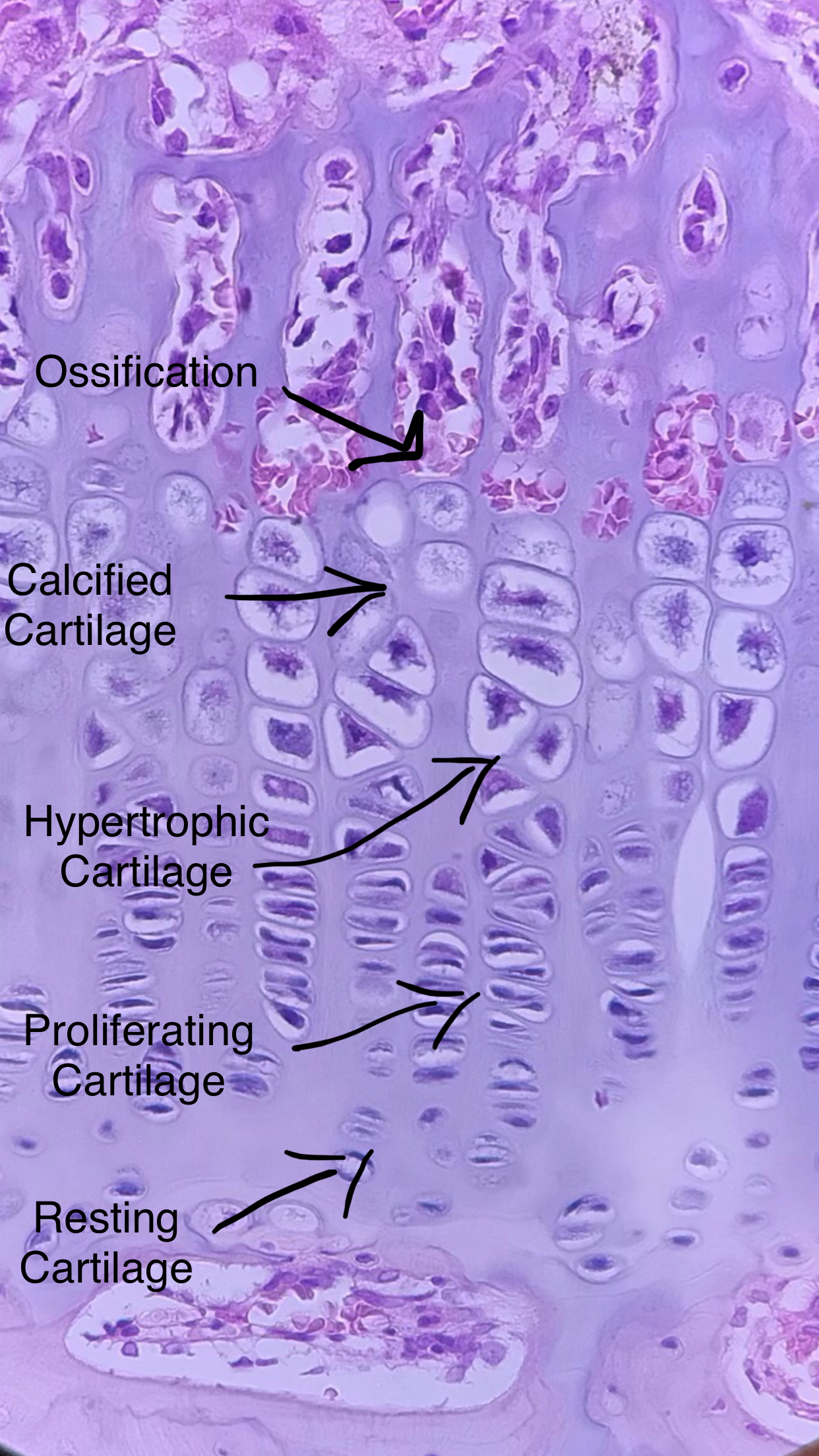 Growth Plate