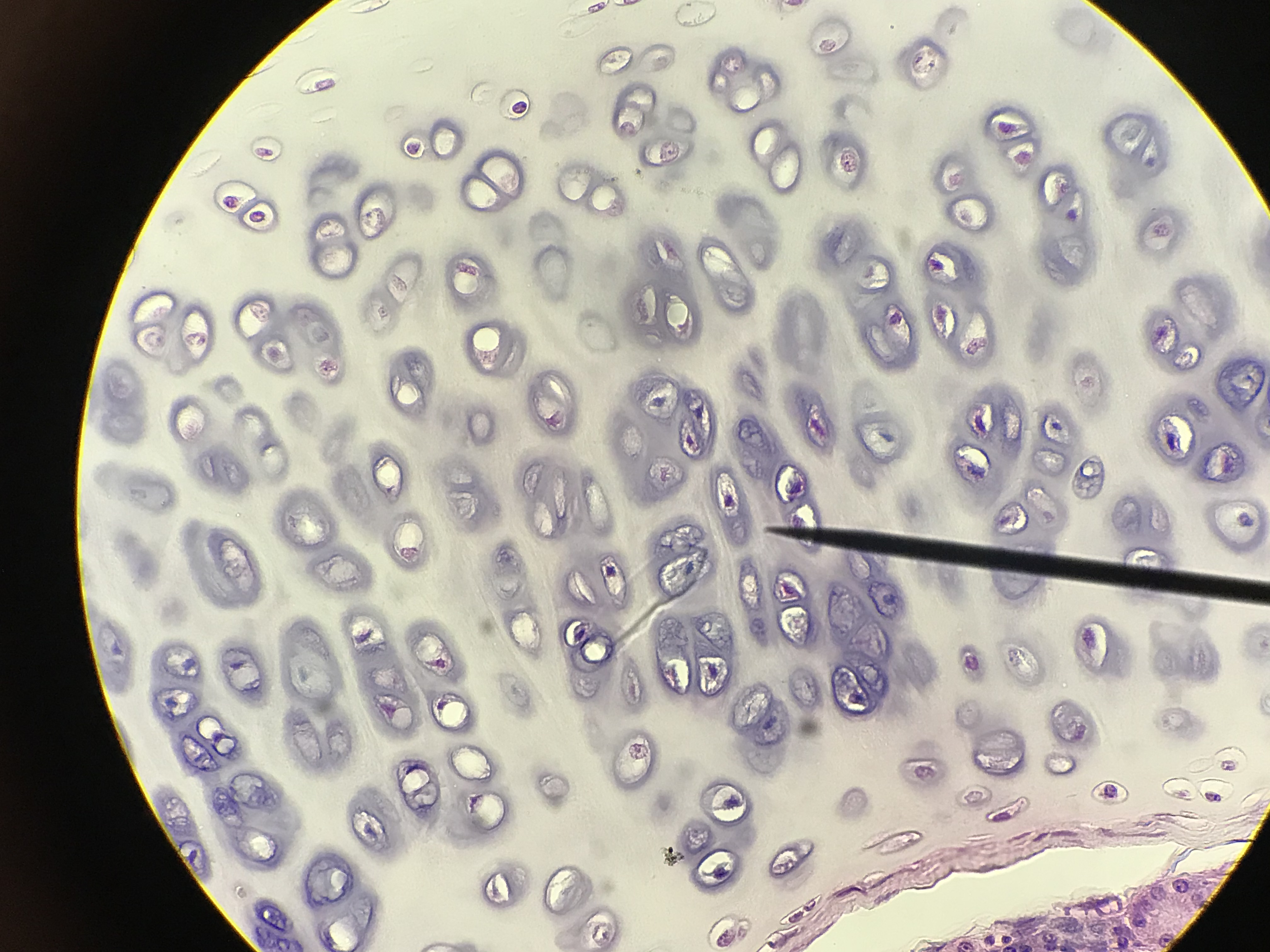 hyaline cartilage