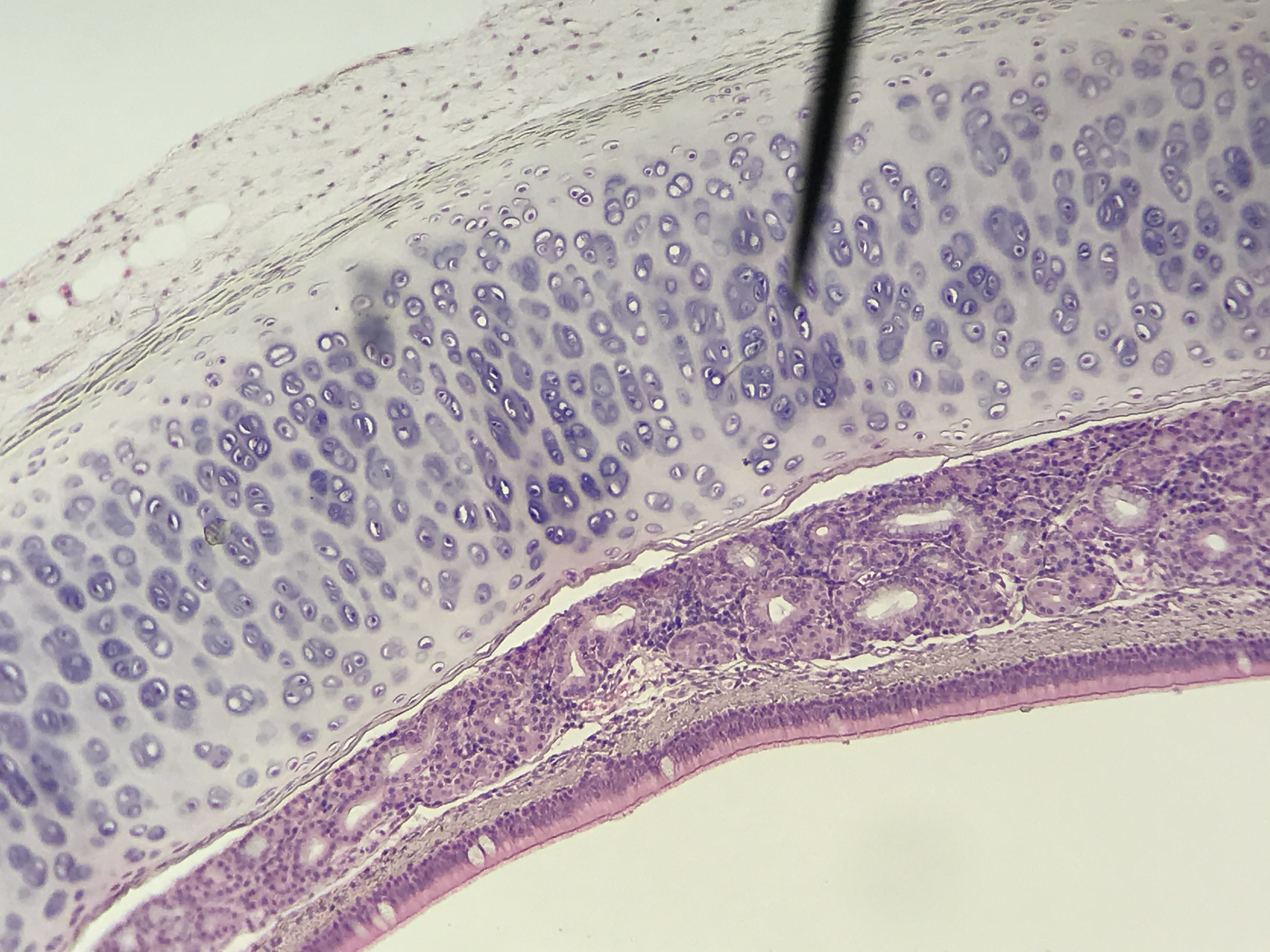 hyaline cartilage