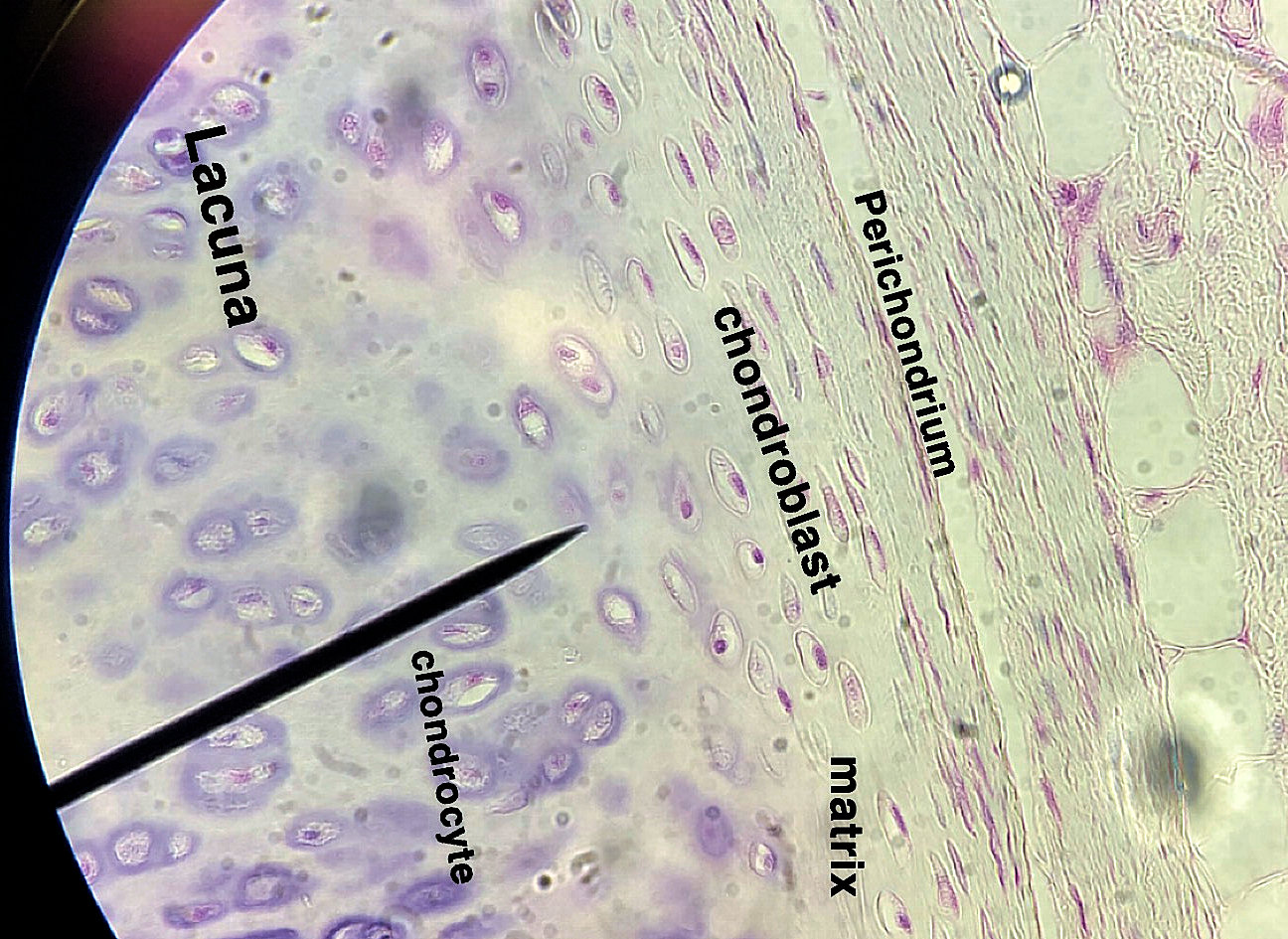 hyaline cartilage