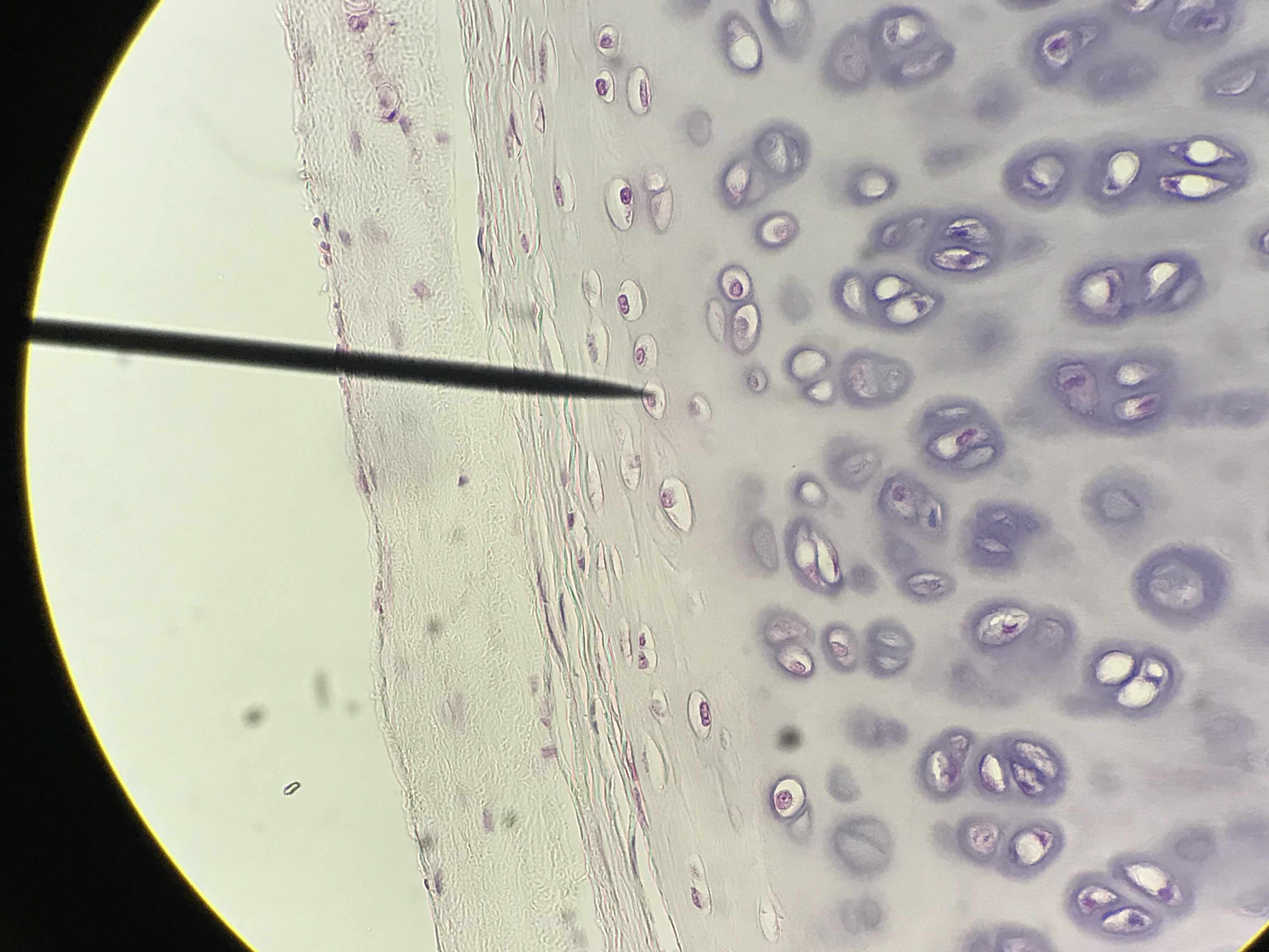 hyaline cartilage