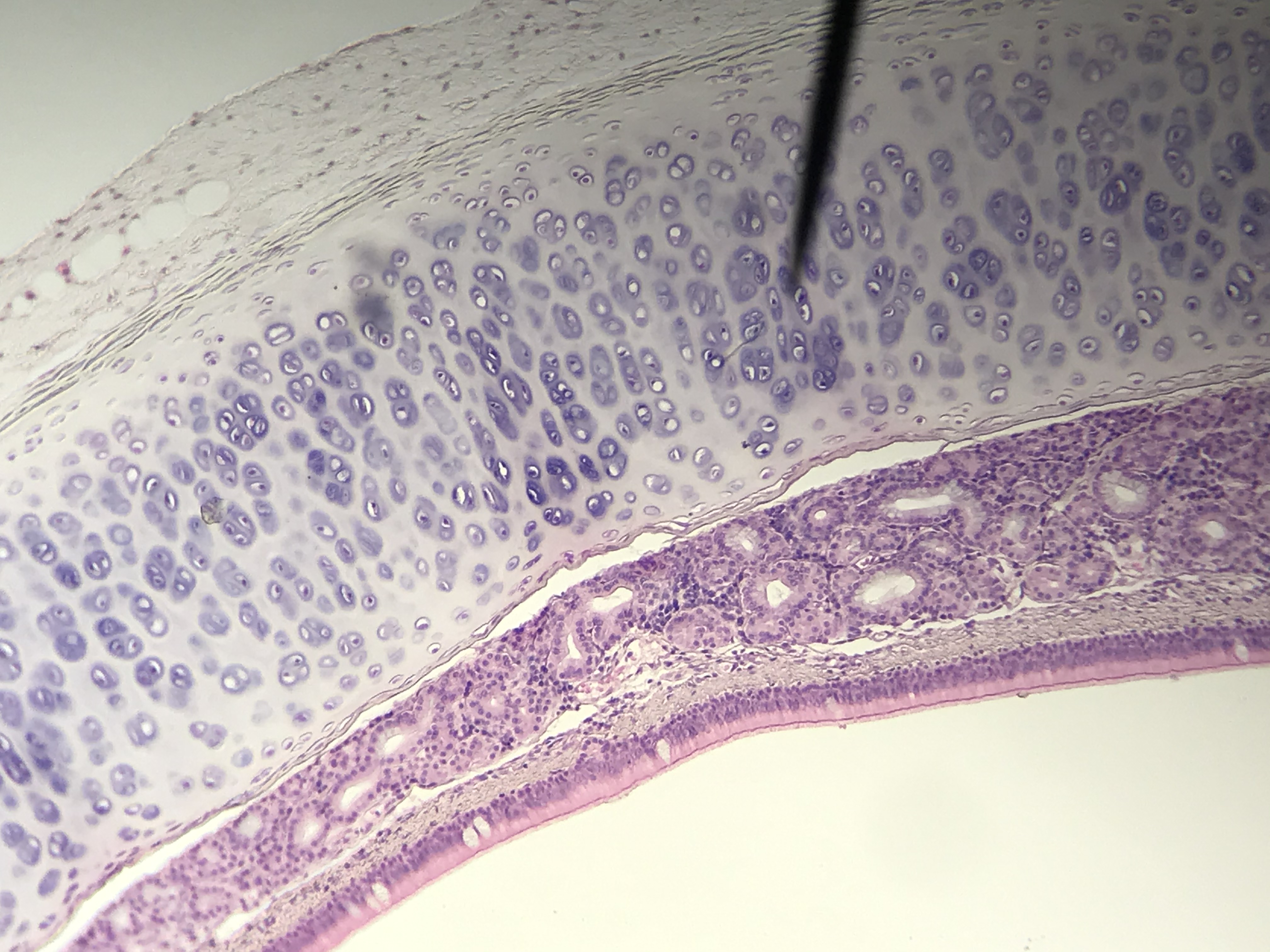 hyaline cartilage