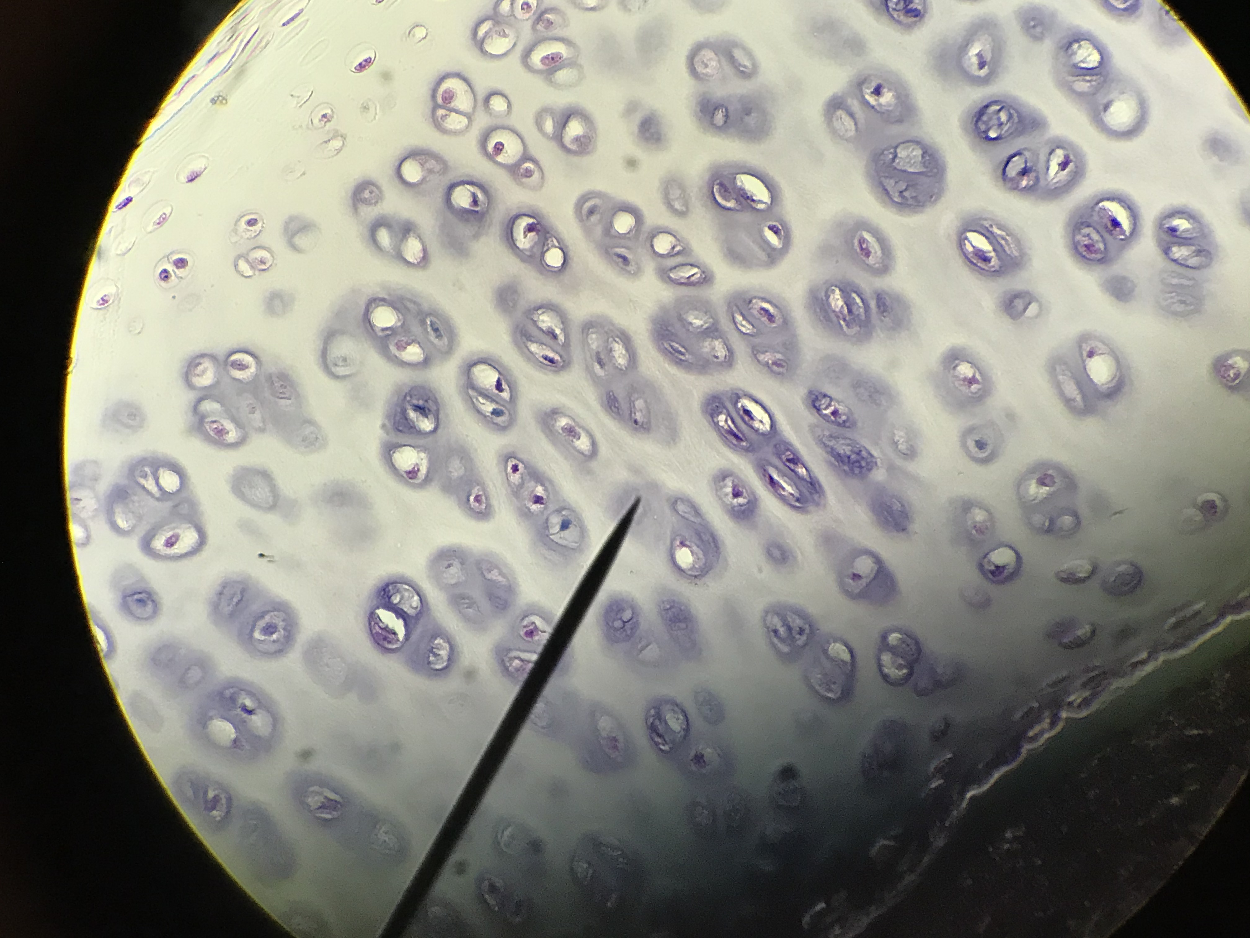 hyaline cartilage