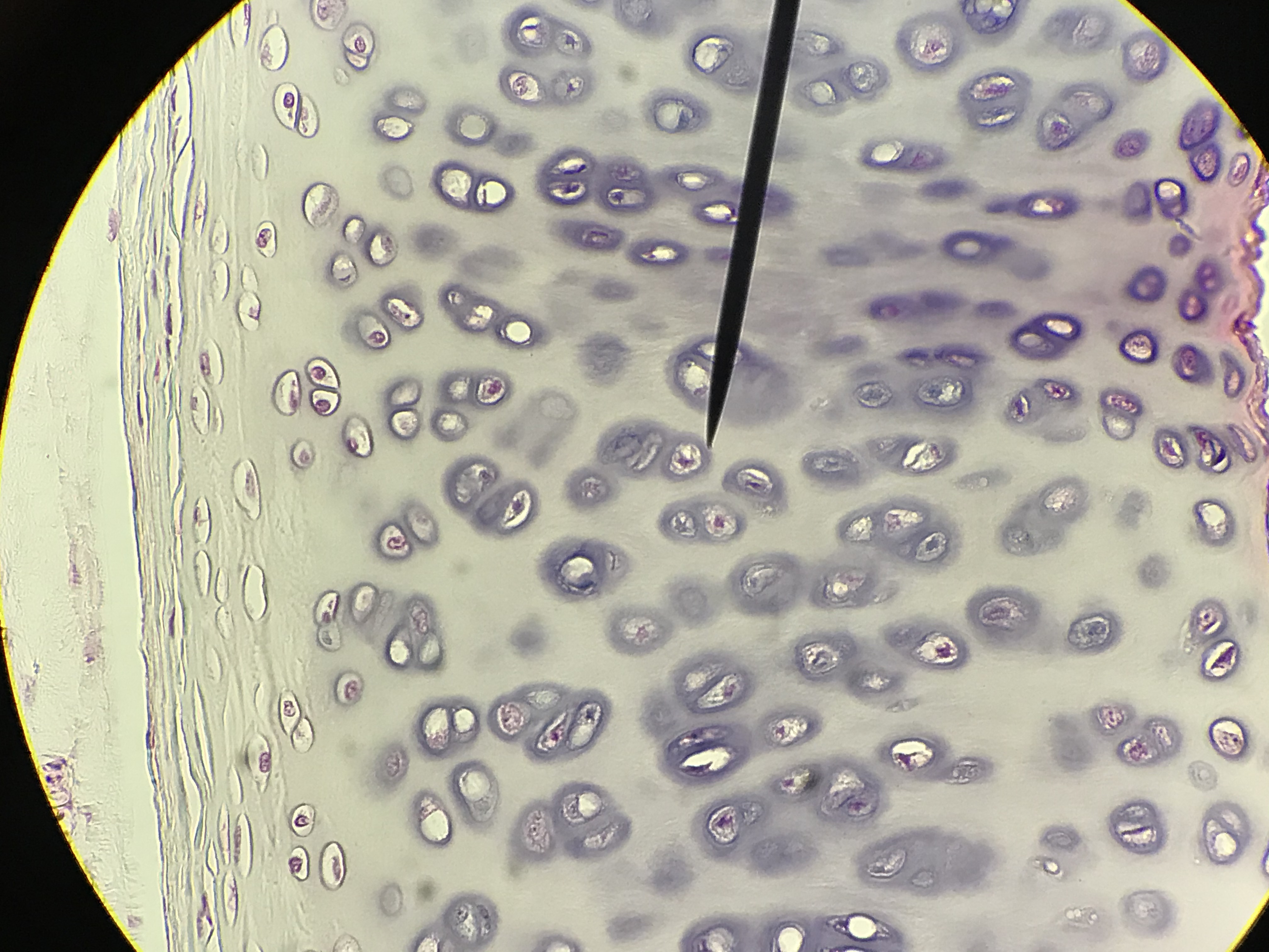 hyaline cartilage