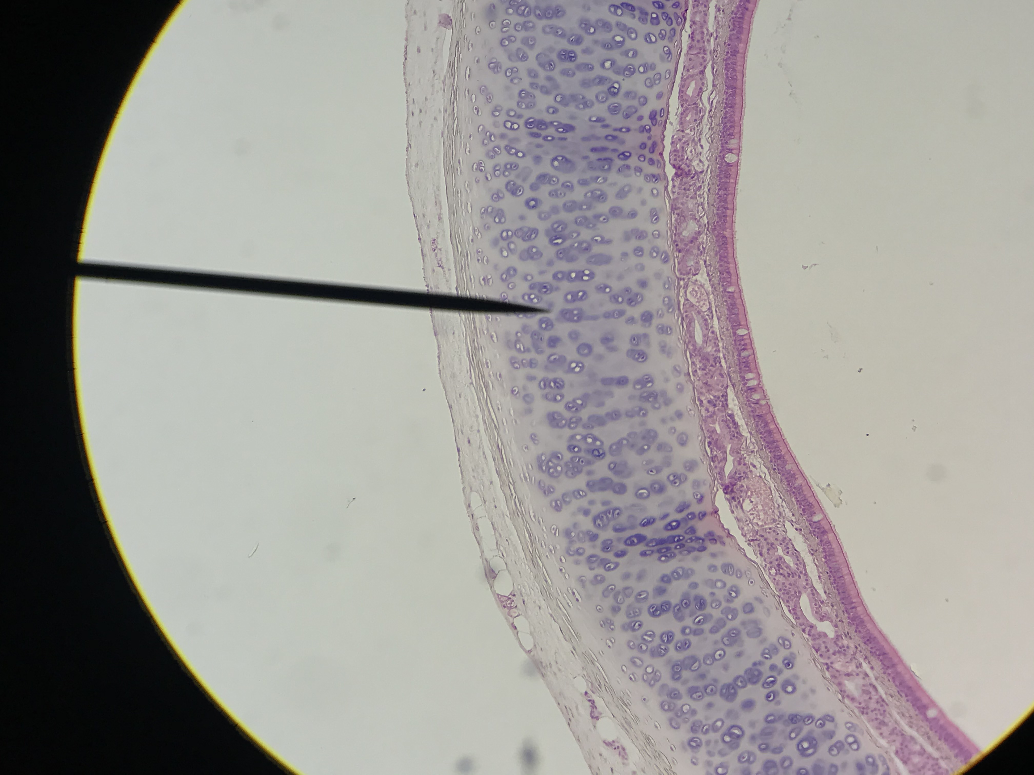 hyaline cartilage