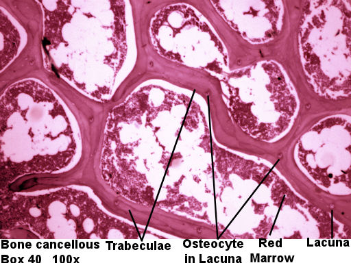 Labeled  Picture