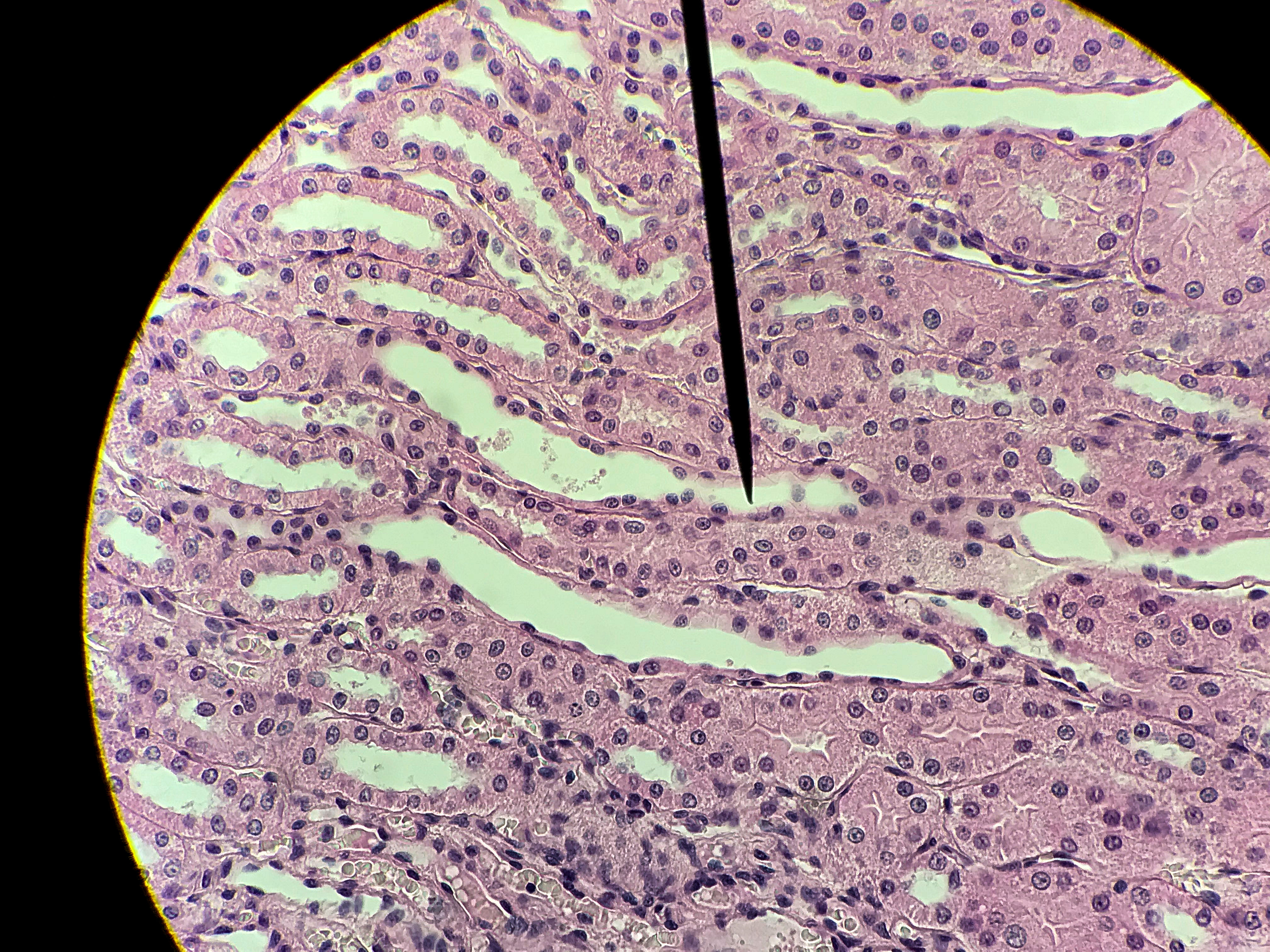 Renal Medulla