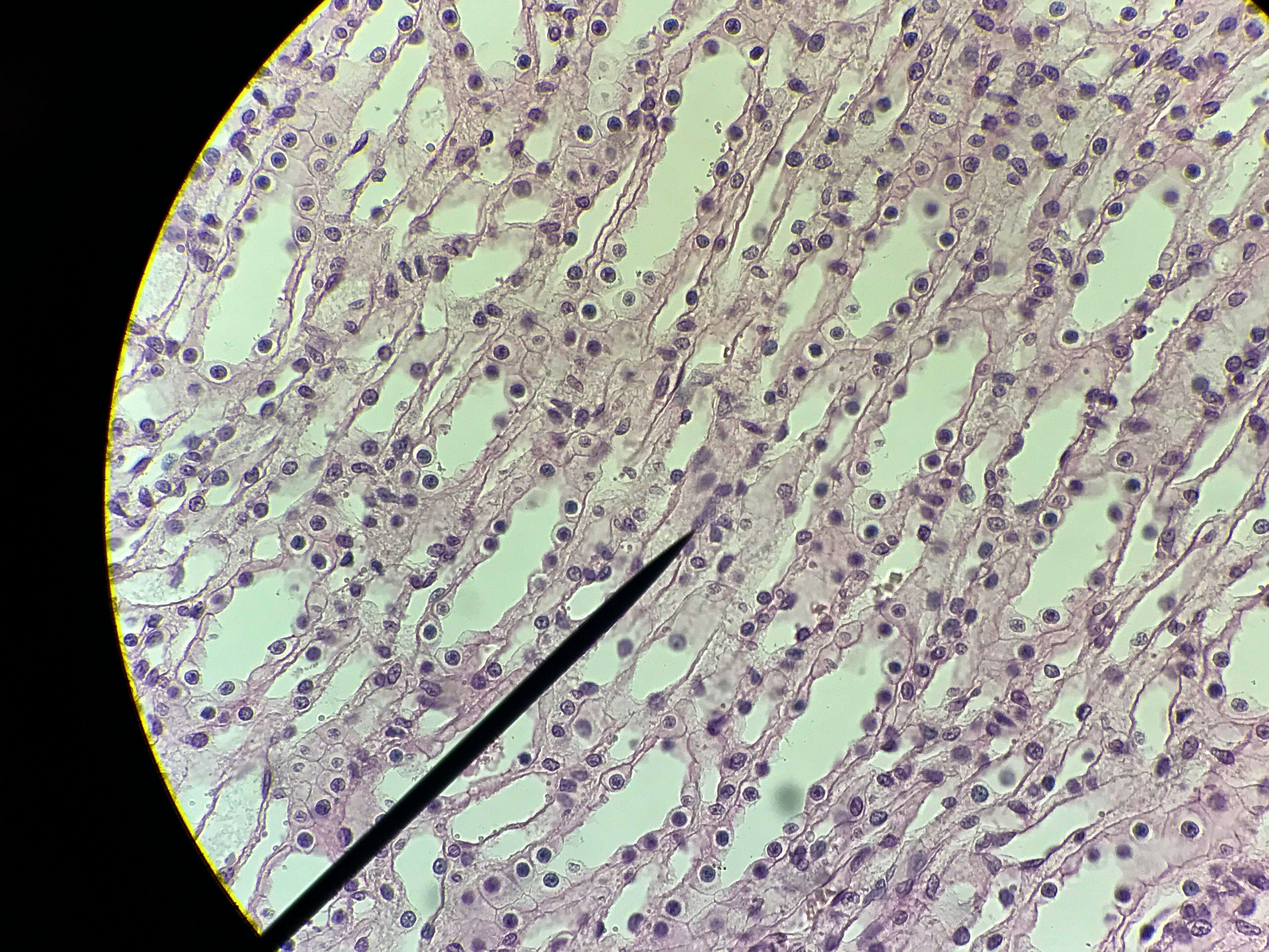 Renal Medulla