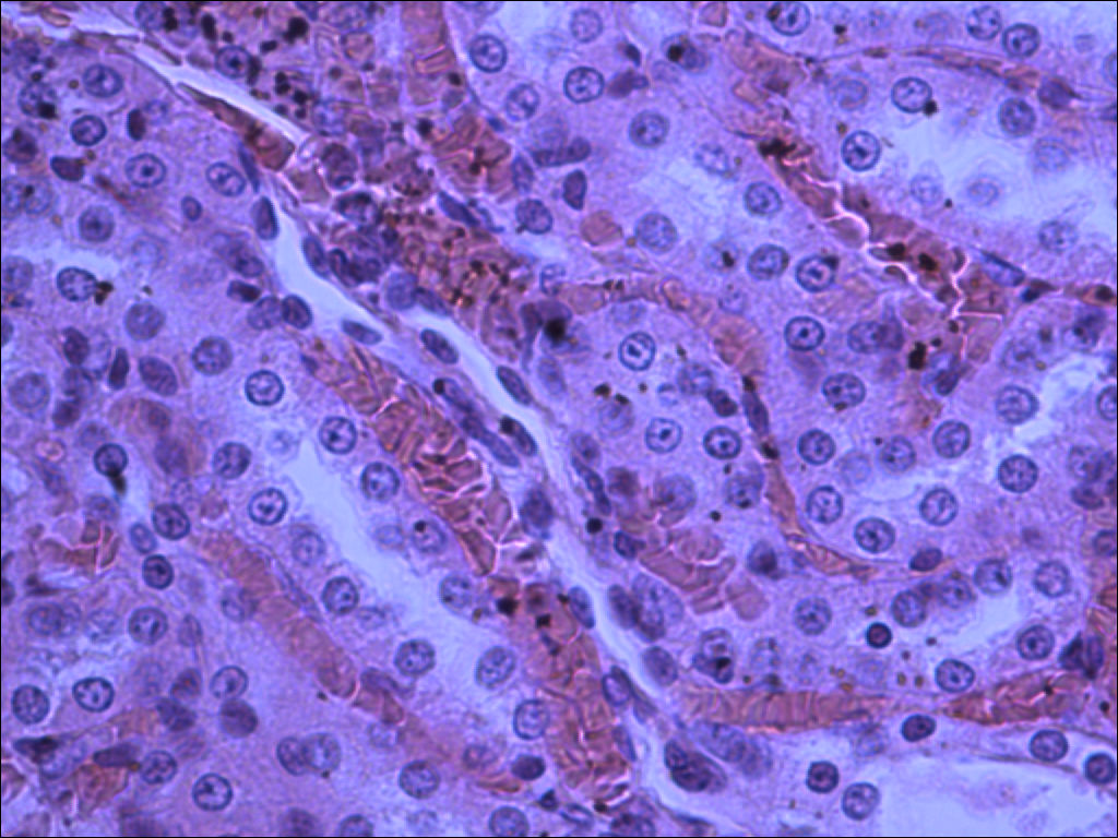 Renal Medulla