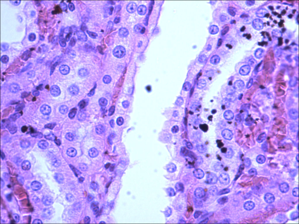 Renal Medulla