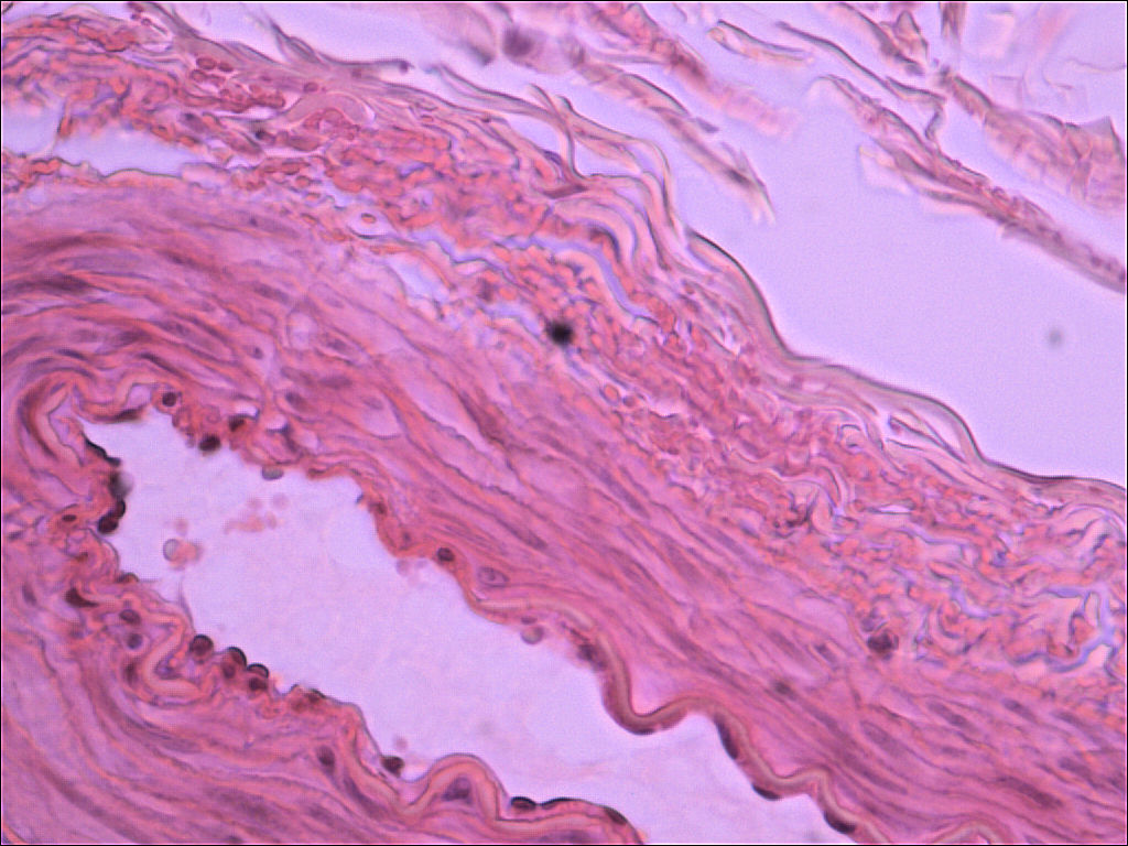 Blood Vessel Histology