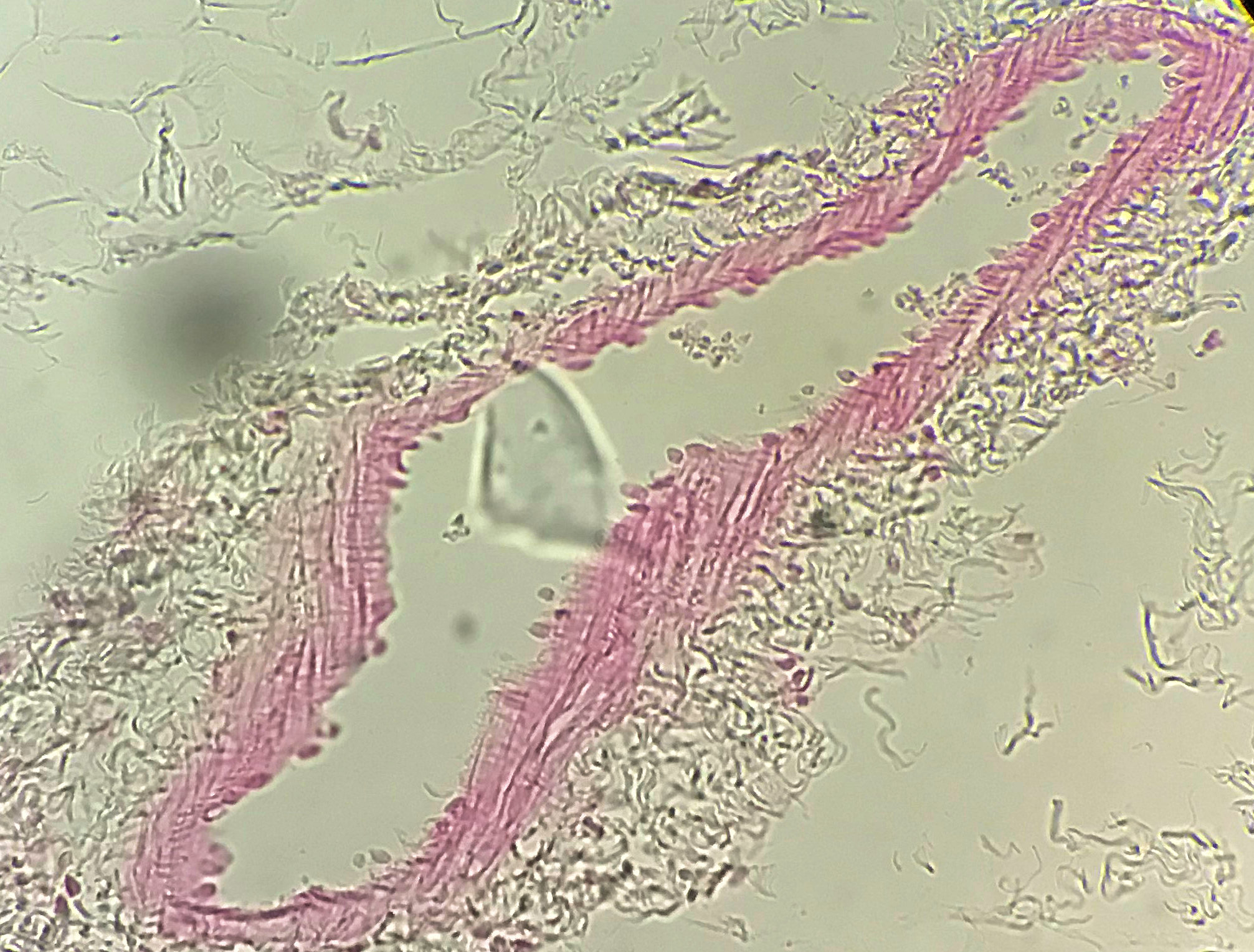 Blood Vessel Histology