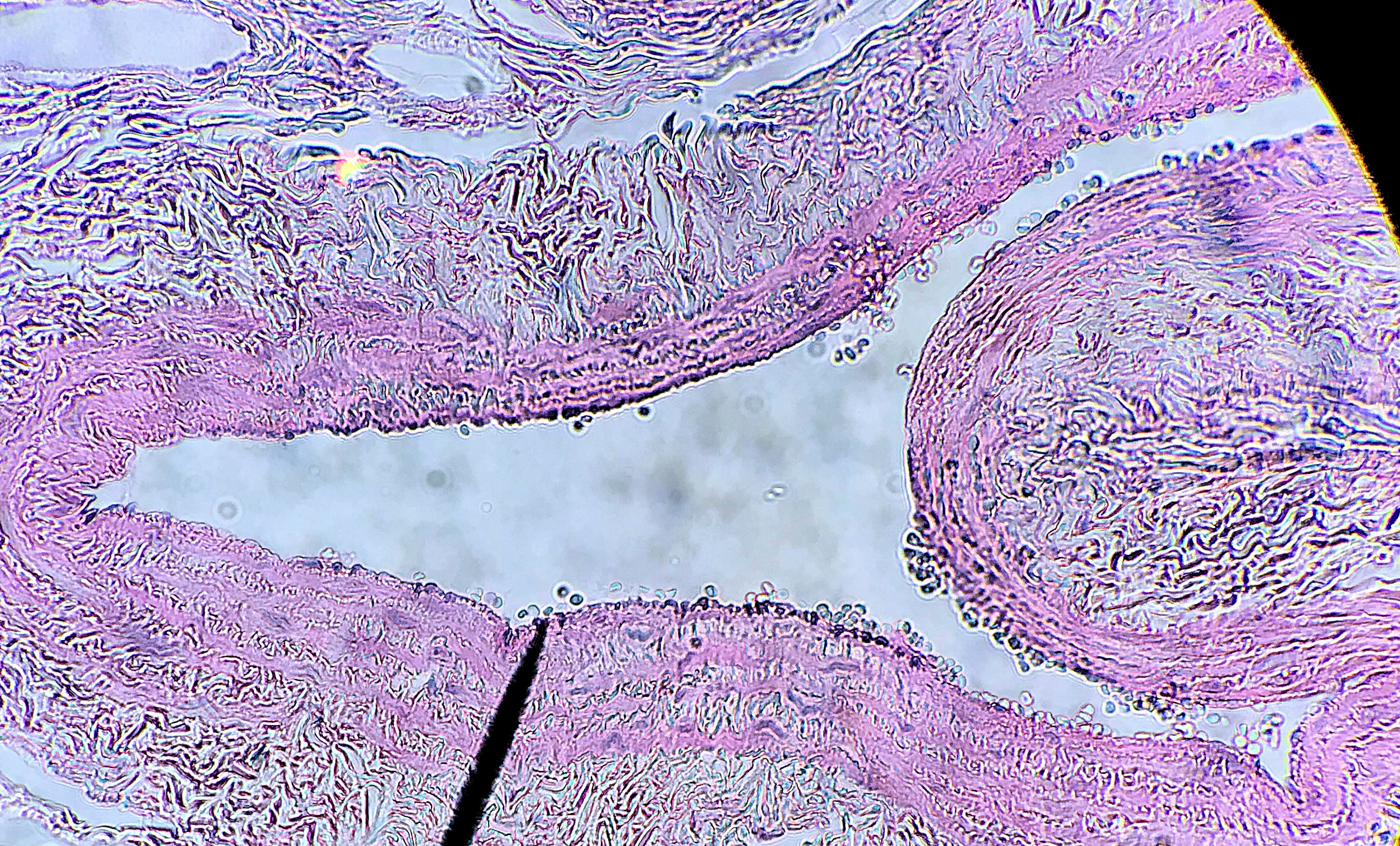 Blood Vessel Histology