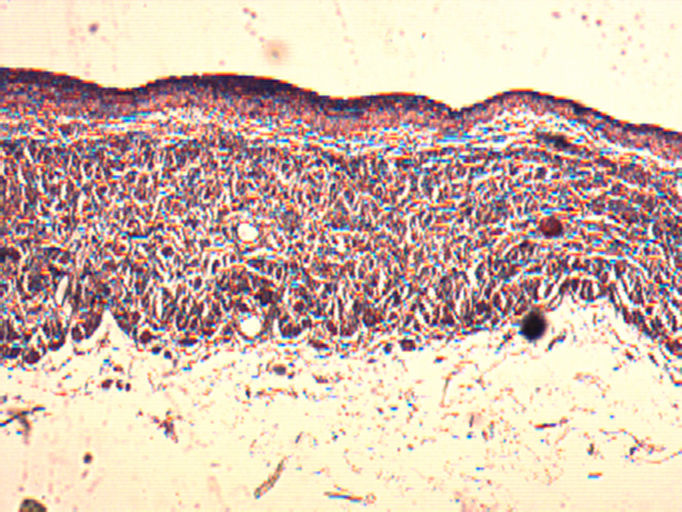 Vena Cava