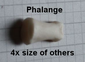 Proximal Phalange