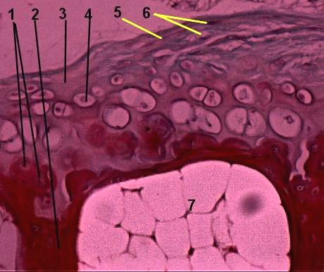 Fibrocartilage