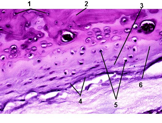 Fibrocartilage easy