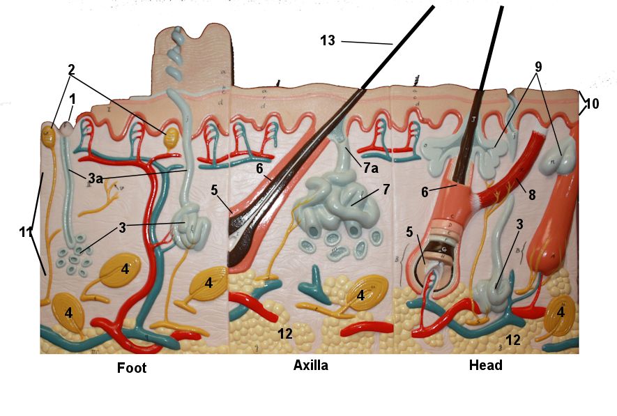 Skin model with burns on back