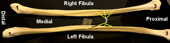 fibula