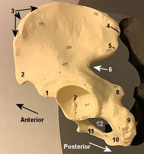 Lateralal Hop Model