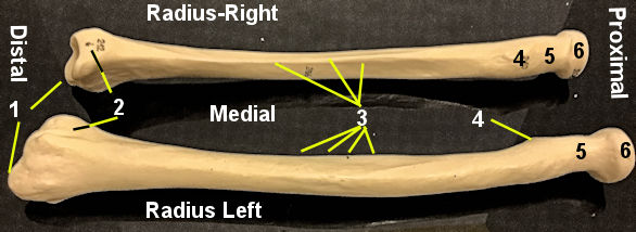 Radius Model