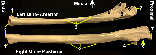 Ulna Model