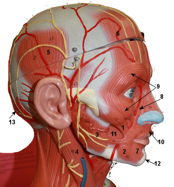 lateral head