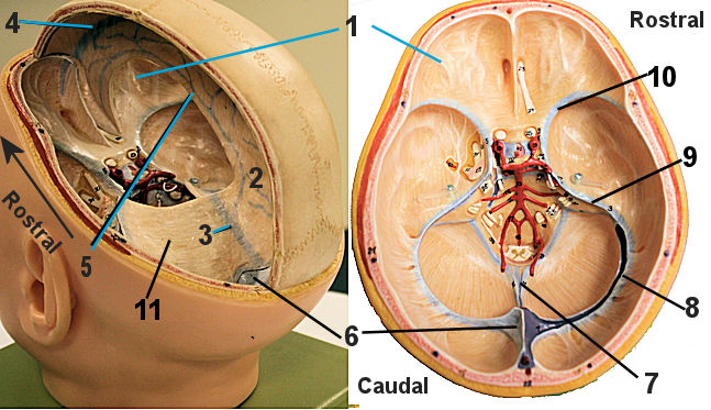 Sinuses and septa