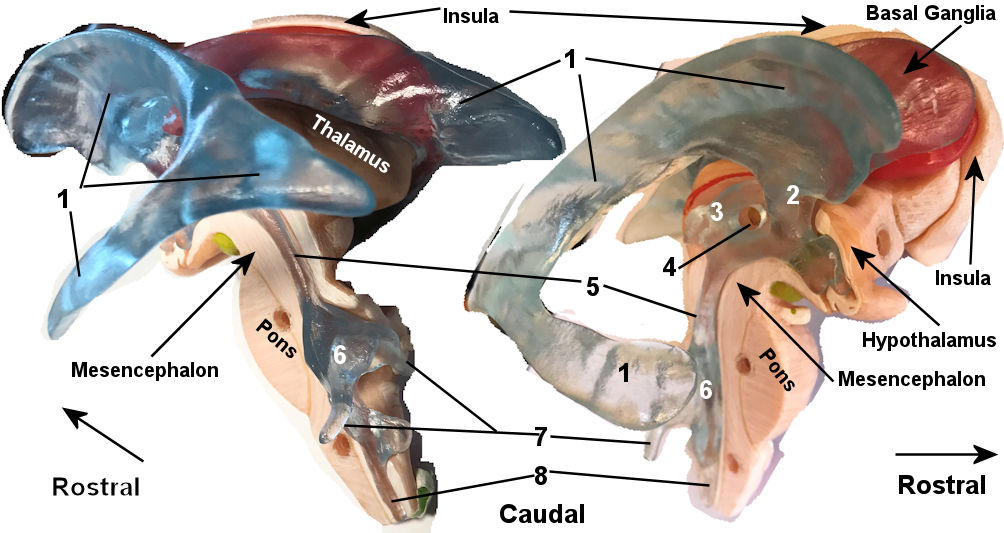 Ventricles